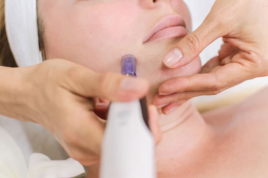 Transforma tu piel con el tratamiento Dermapen de Sani Estetic